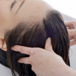 【プレオスカルプシャンプー】口コミから明らかな脱毛期に使うべき理由